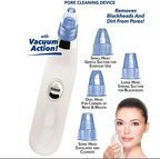4-in-1 Blackhead Extractor – Vacuum Suction Acne Remover & Pore Cleaner
